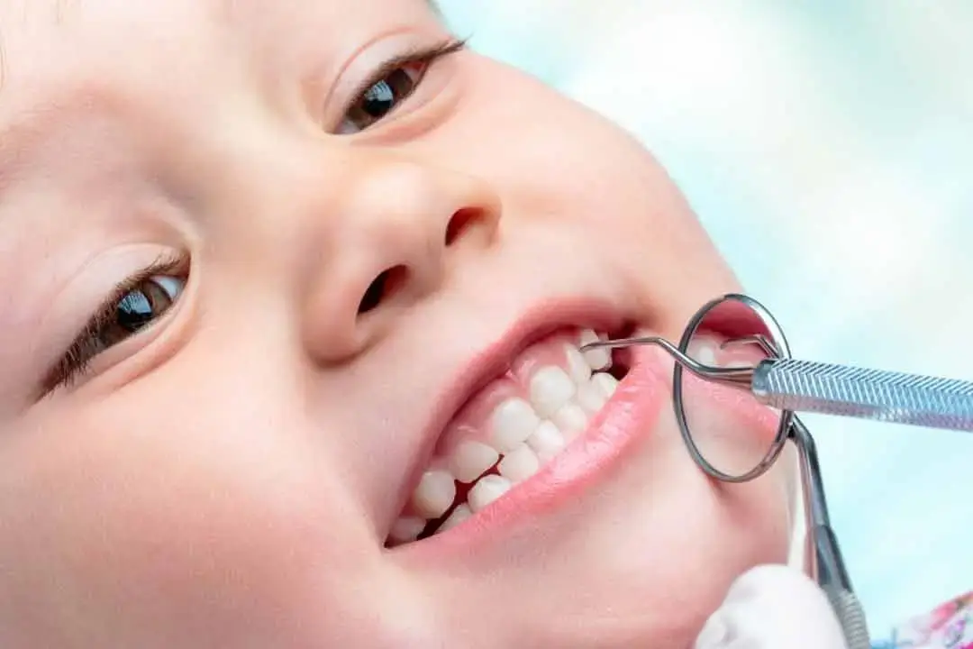 افضل طبيب اسنان اطفال في الرياض - دنتكس