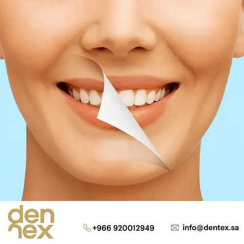 شروط تركيب ابتسامة هوليود أو تركيبة زيركون | عيادة دنتيكس