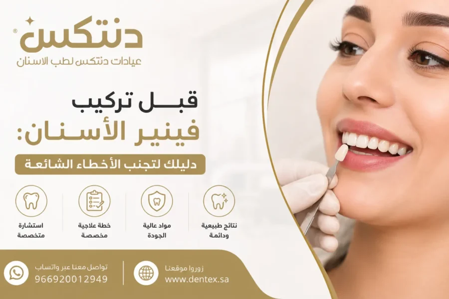 قبل تركيب فينير الأسنان دليلك لتجنب الأخطاء الشائعة - دنتكس