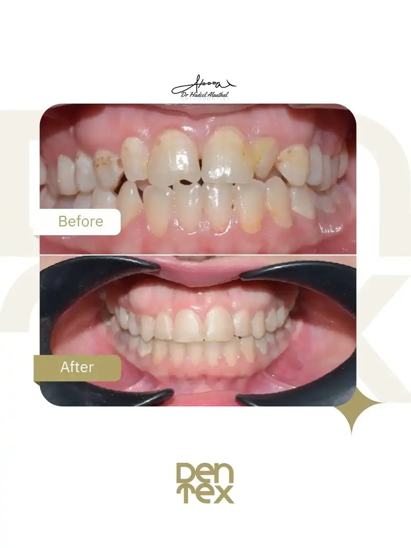 عيادة تقويم أسنان بالرياض تقدم أرخص الأسعار 2026