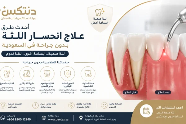 أحدث طرق علاج انحسار اللثة بدون جراحة في السعودية - دنتكس