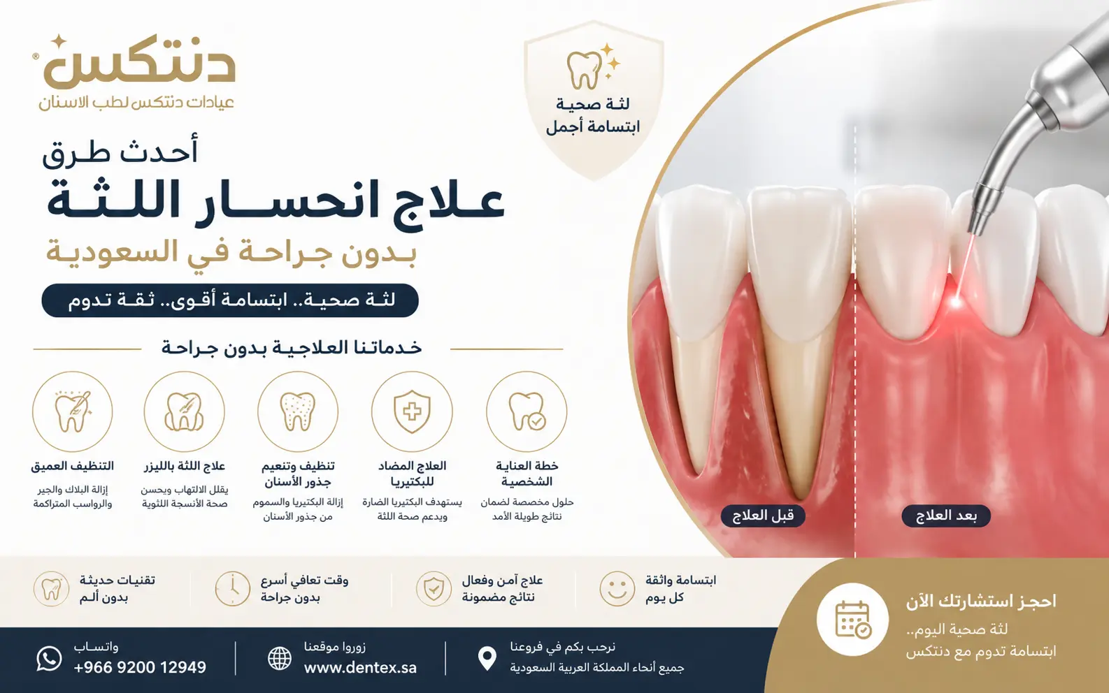 أحدث طرق علاج انحسار اللثة بدون جراحة في السعودية - دنتكس