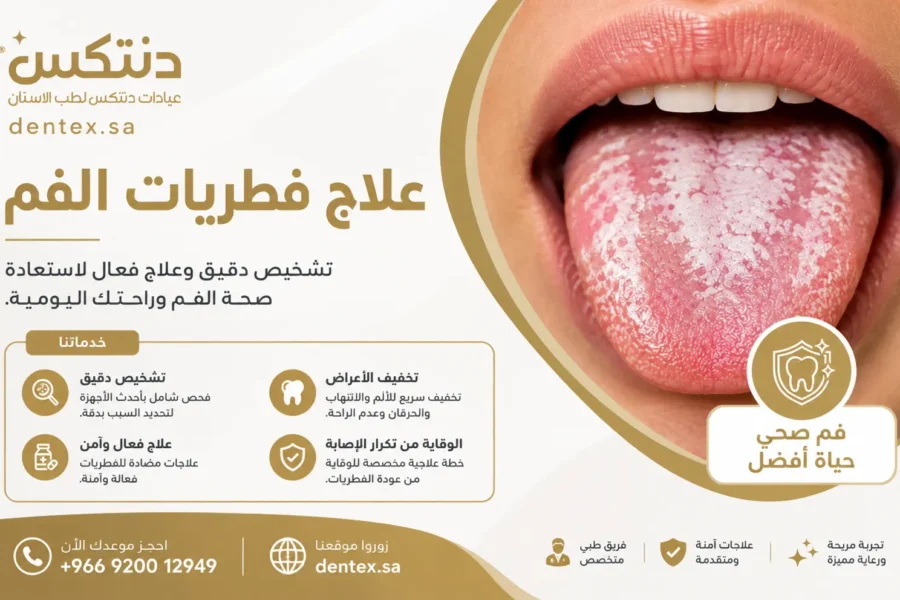 علاج فطريات الفم الأسباب والأعراض وأفضل علاج آمن - دنتكس