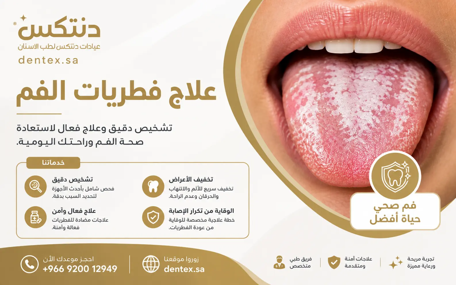 علاج فطريات الفم الأسباب والأعراض وأفضل علاج آمن - دنتكس