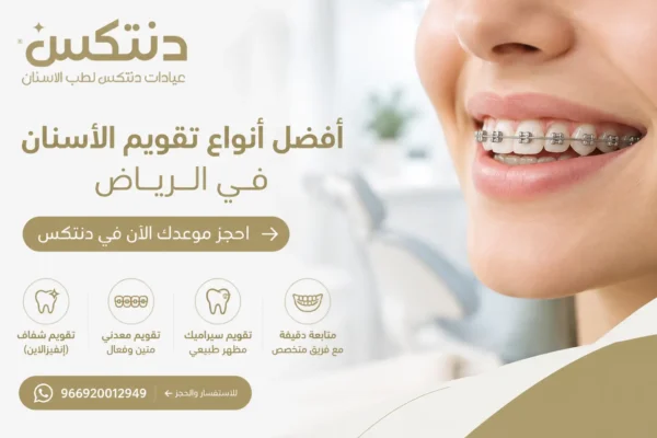 أفضل أنواع تقويم الأسنان في الرياض احجز موعدك الآن في دنتكس