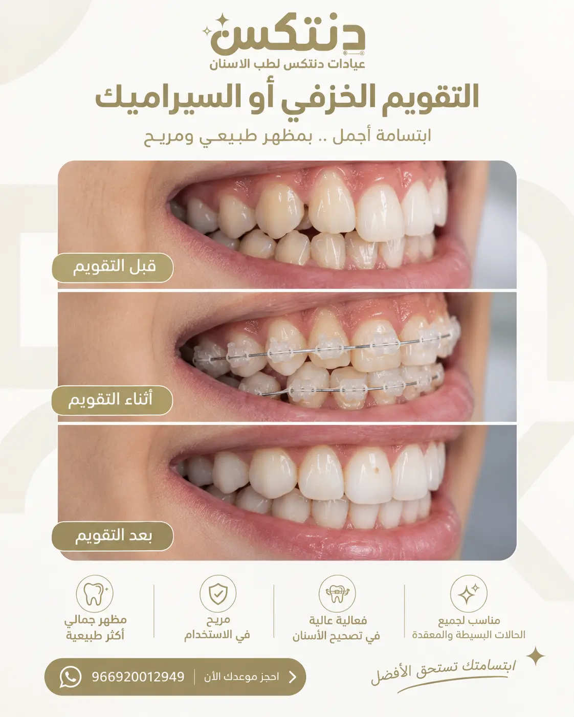 التقويم الخزفي أو السيراميك