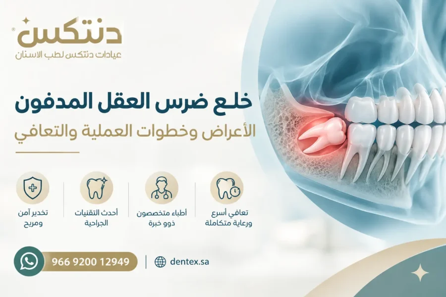 خلع ضرس العقل المدفون الأعراض وخطوات العملية والتعافي - دنتكس
