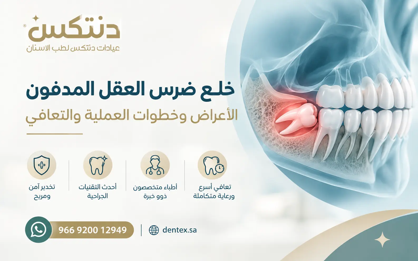 خلع ضرس العقل المدفون الأعراض وخطوات العملية والتعافي - دنتكس