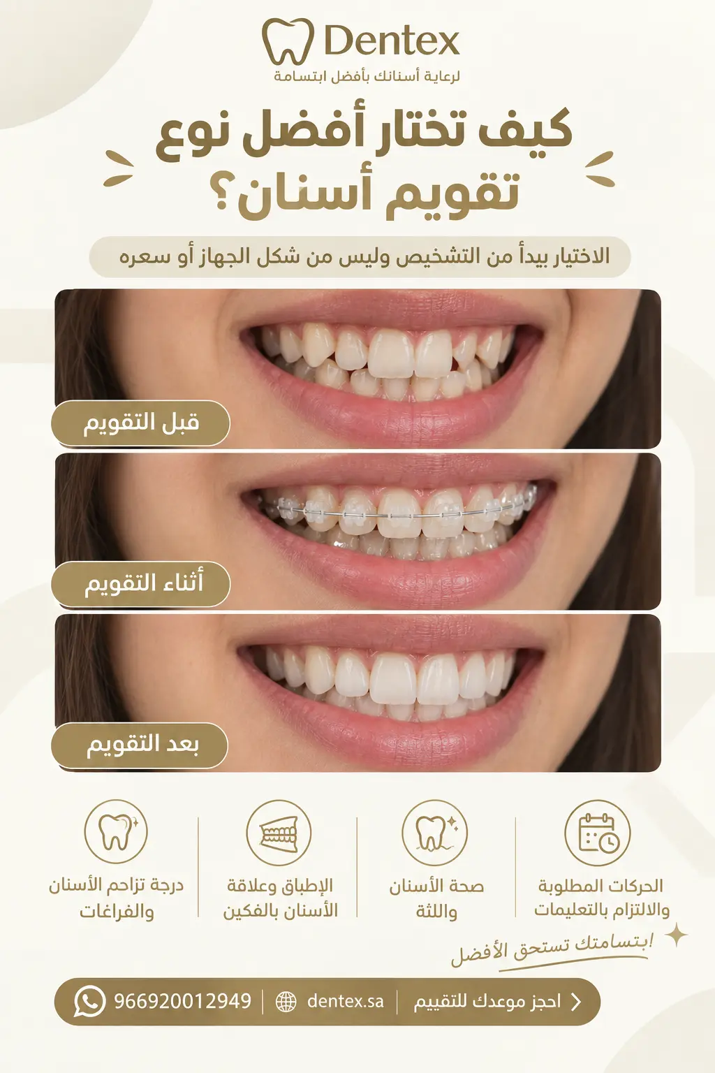 كيف تختار أفضل نوع تقويم أسنان؟ - عيادة دنتكس