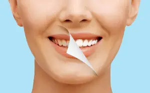 شروط تركيب ابتسامة هوليود أو تركيبة زيركون