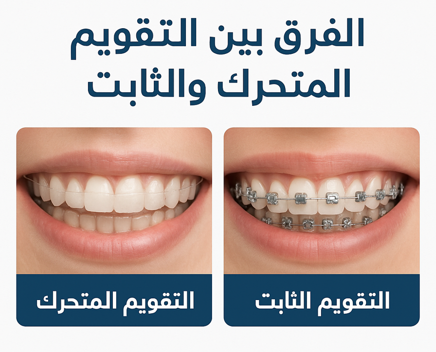 الفرق بين التقويم الثابت والمتحرك