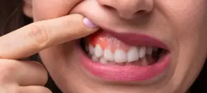 علاج التهاب اللثة مع أفضل دكتور أسنان بالسعودية