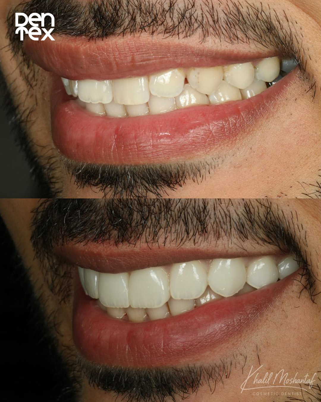 before.after DENTEX (2)